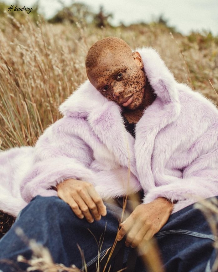 Freckles Took Him From Being Bullied To Being A Super Model; Meet Ralph Souffrant
