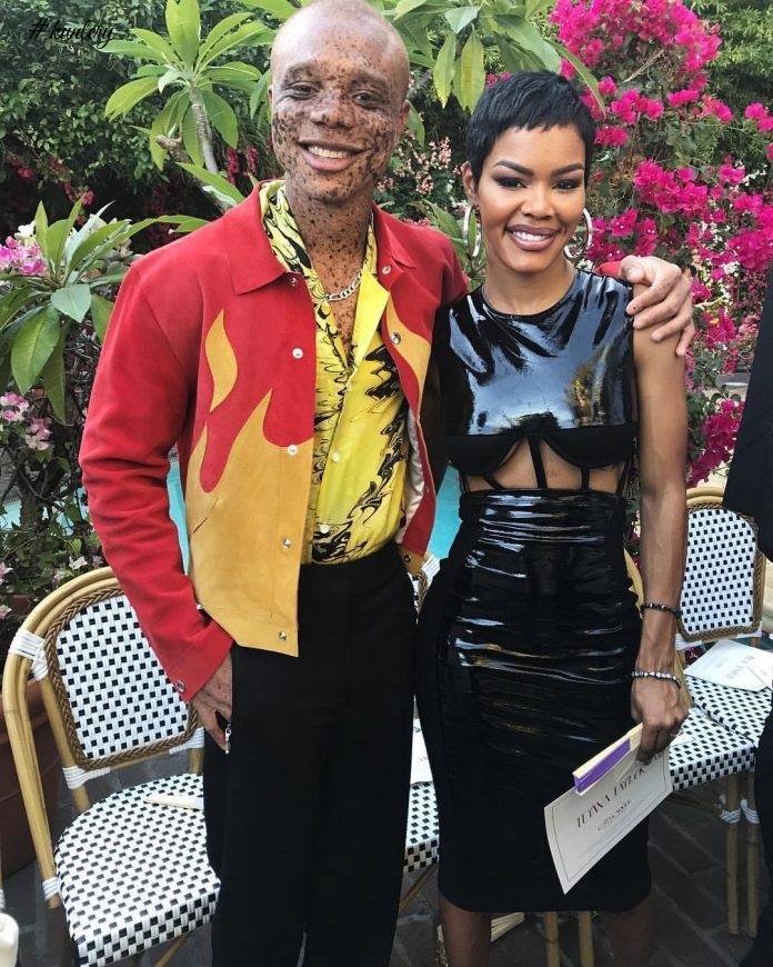Freckles Took Him From Being Bullied To Being A Super Model; Meet Ralph Souffrant