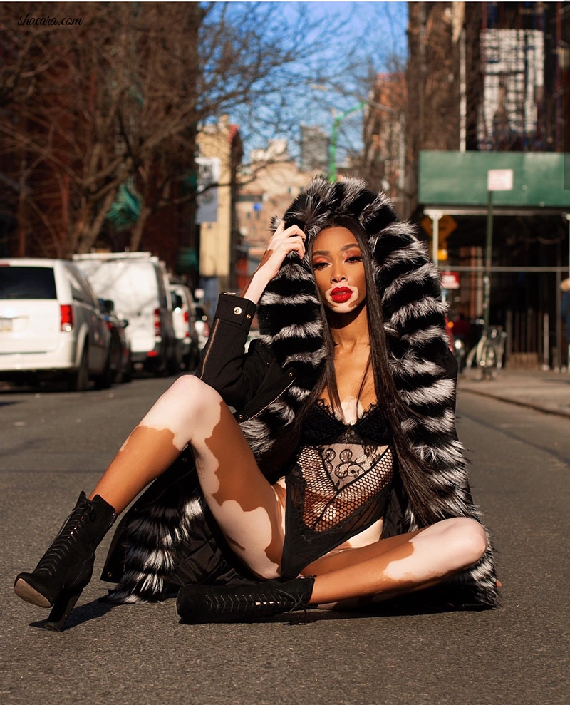 Vitiligo Model Winnie Breaks The Net Already In 2019 With This Fur Coat NYC Shoot