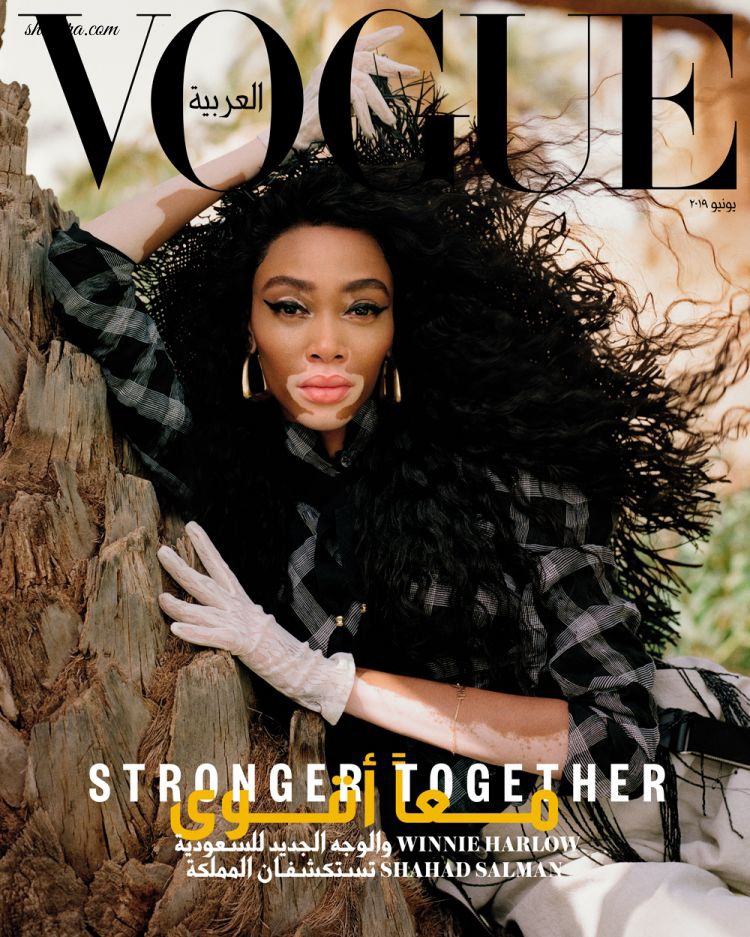 Vitiligo Can’t Stop Their Dreams! Models Winnie Harlow & Sahad Salman’s Inspiring Story in Vogue Arabia